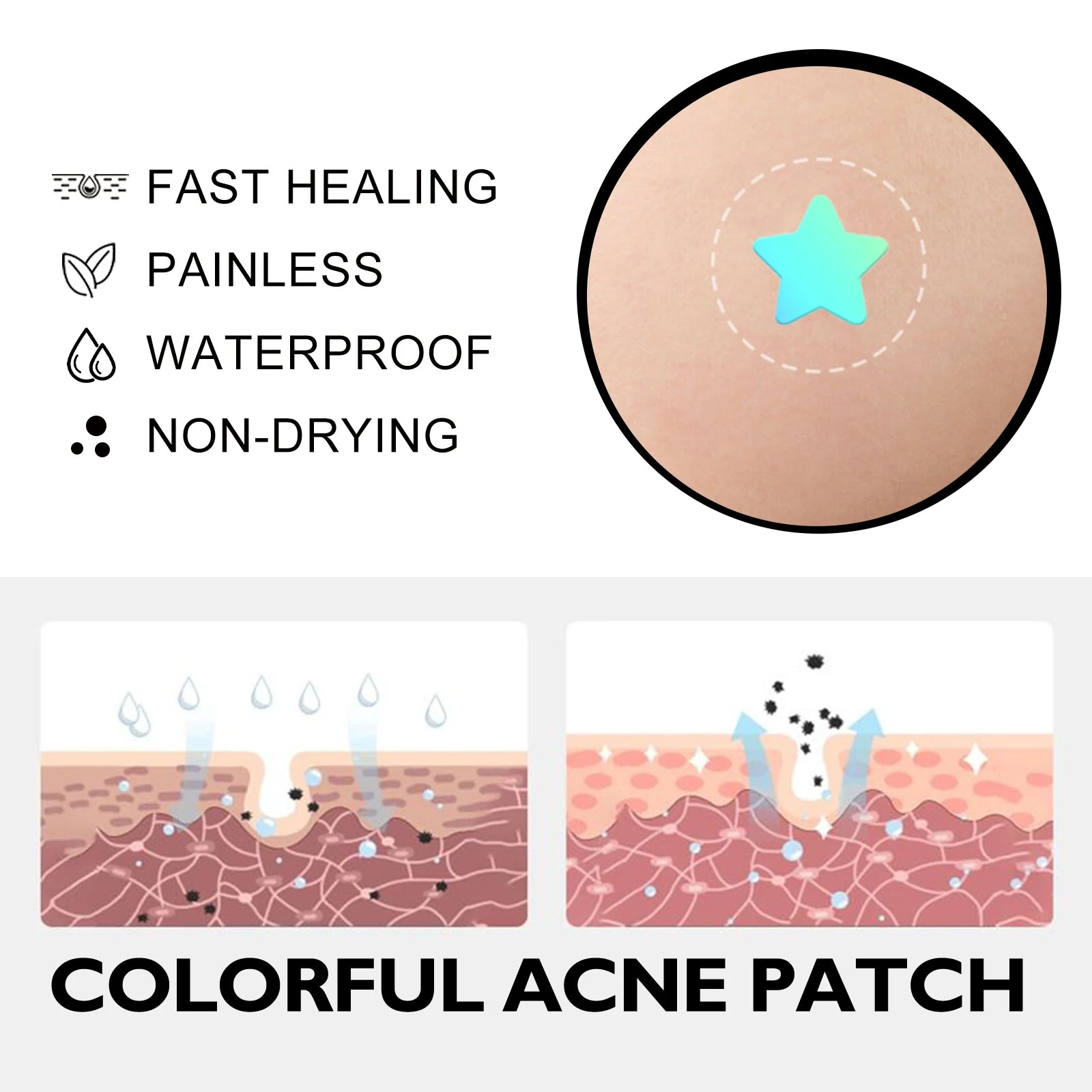 Hoygi Cute Color Acne Care Patches