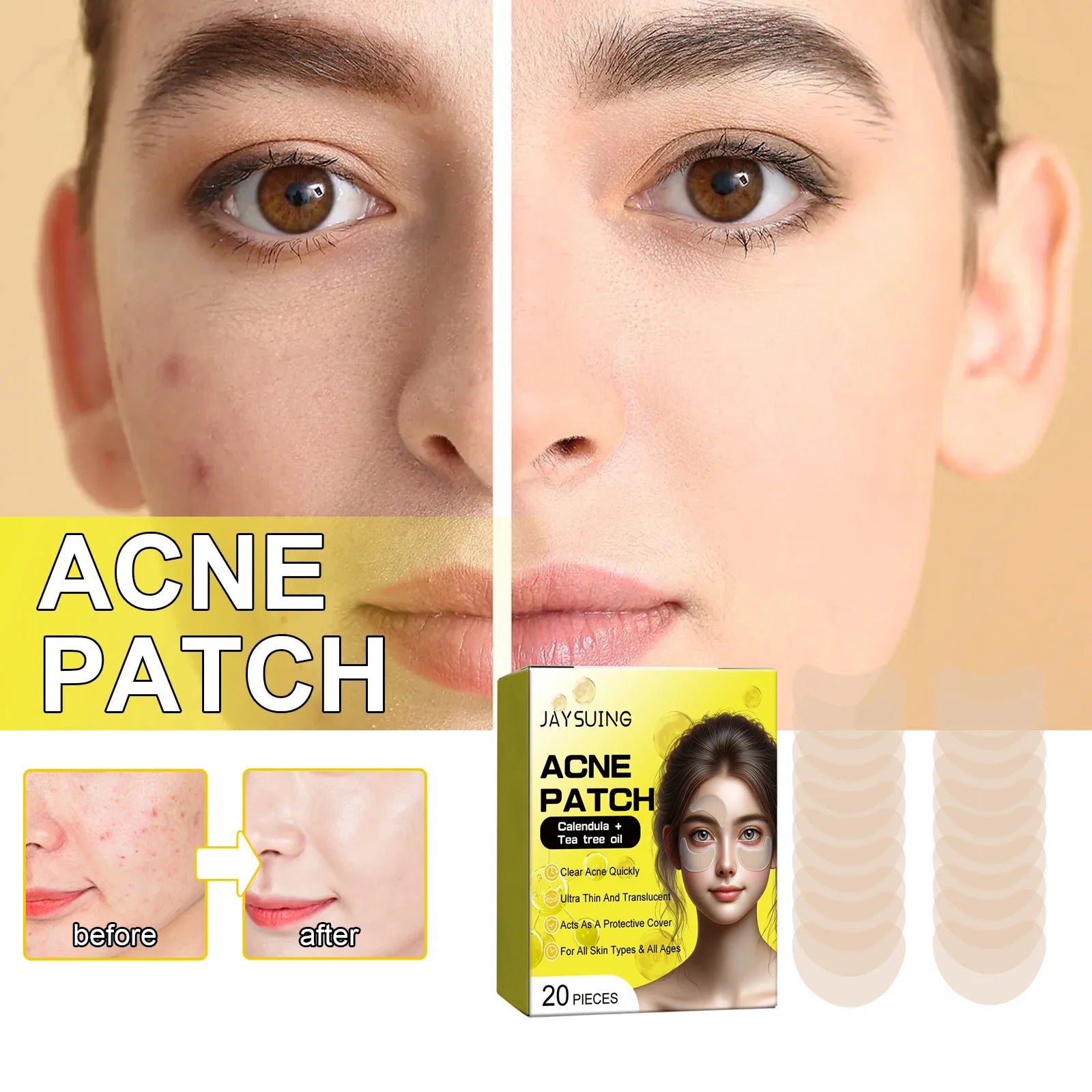 Invisible Acne Dots Pimple Patch Stickers