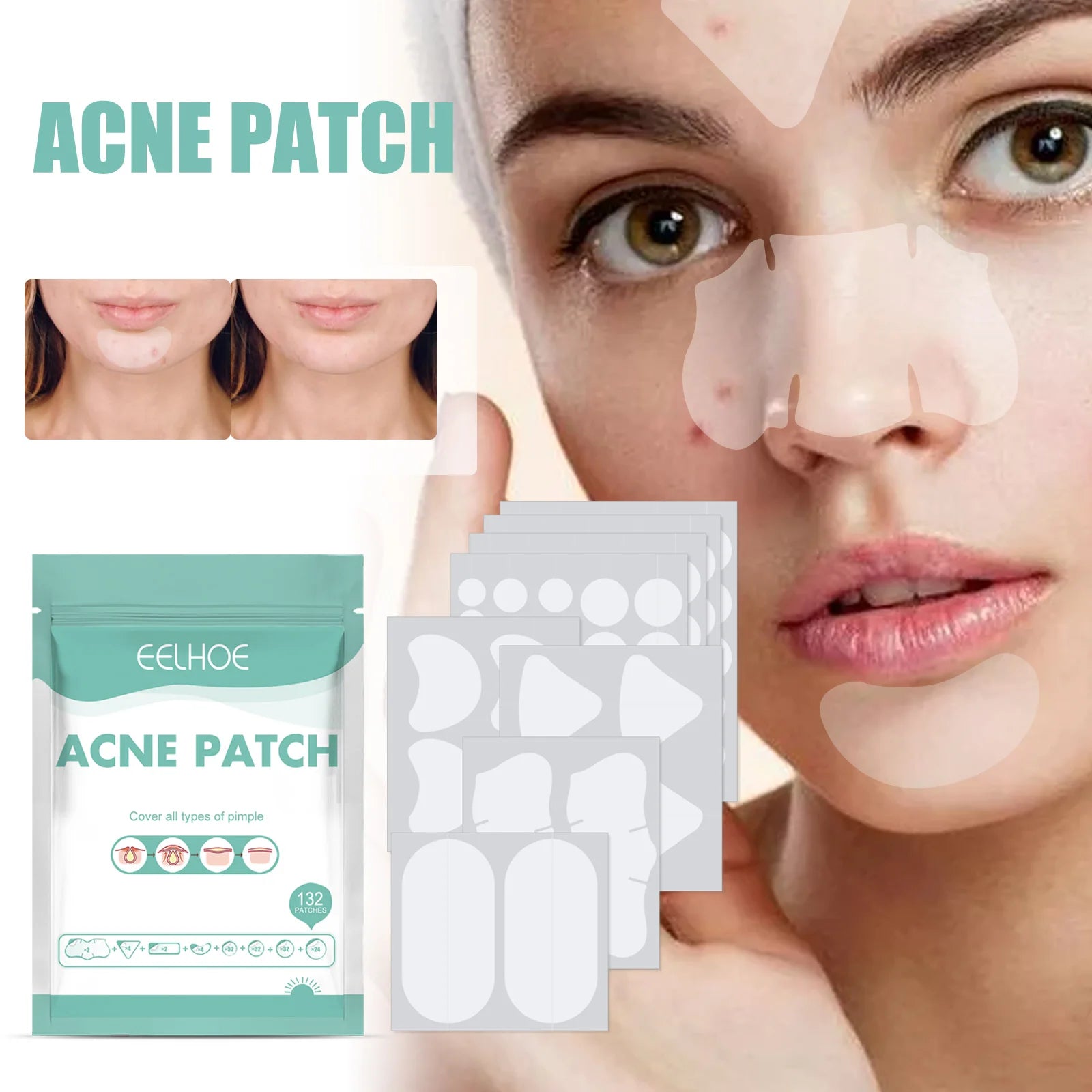 EELHOE Full Face Acne Relief Patch