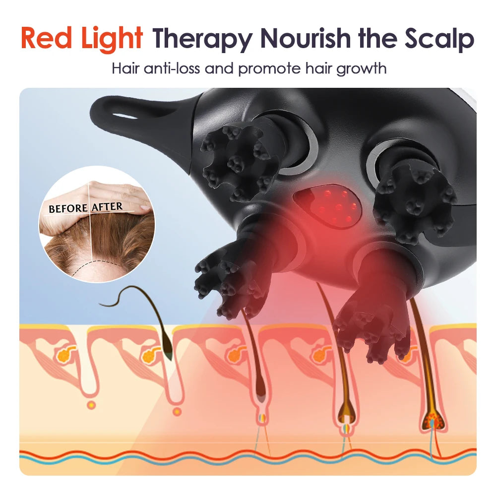 Electric Scalp & Migraine Relief Massager