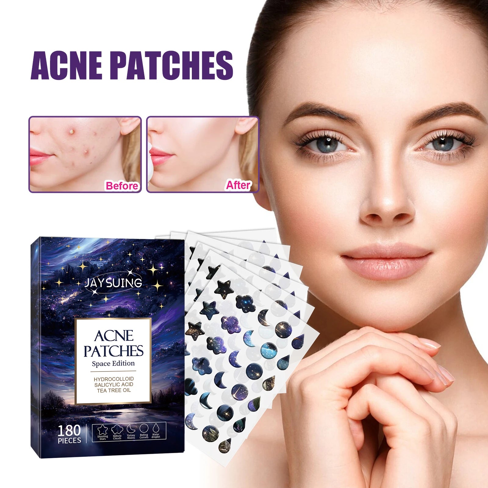 180Pcs Water Gel Acne Patch Set
