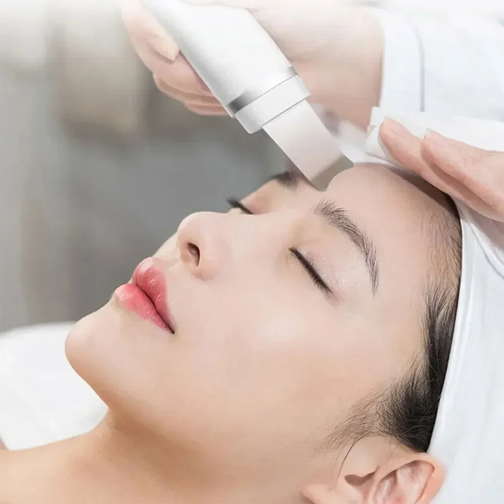 Vibrating Facial Peeling Skin Scrubber