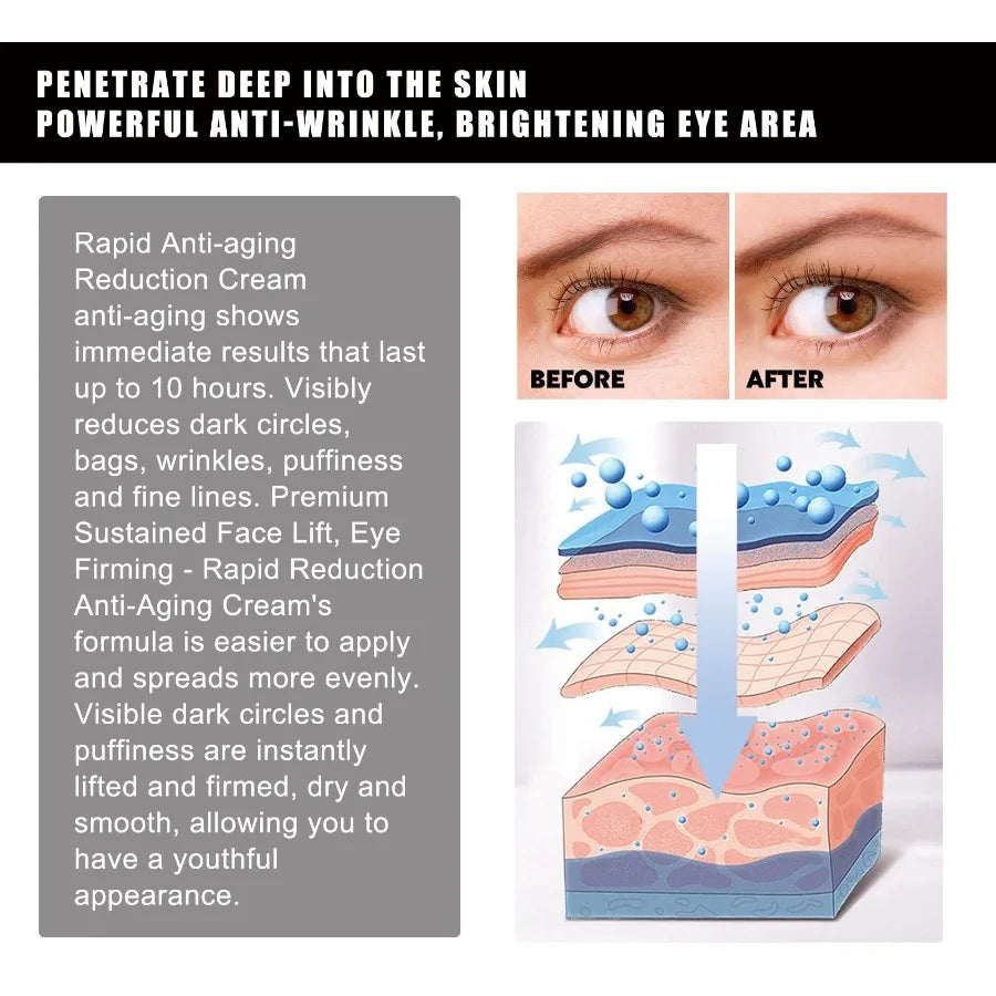 Hoygi Strawberry Gel Eye Patches