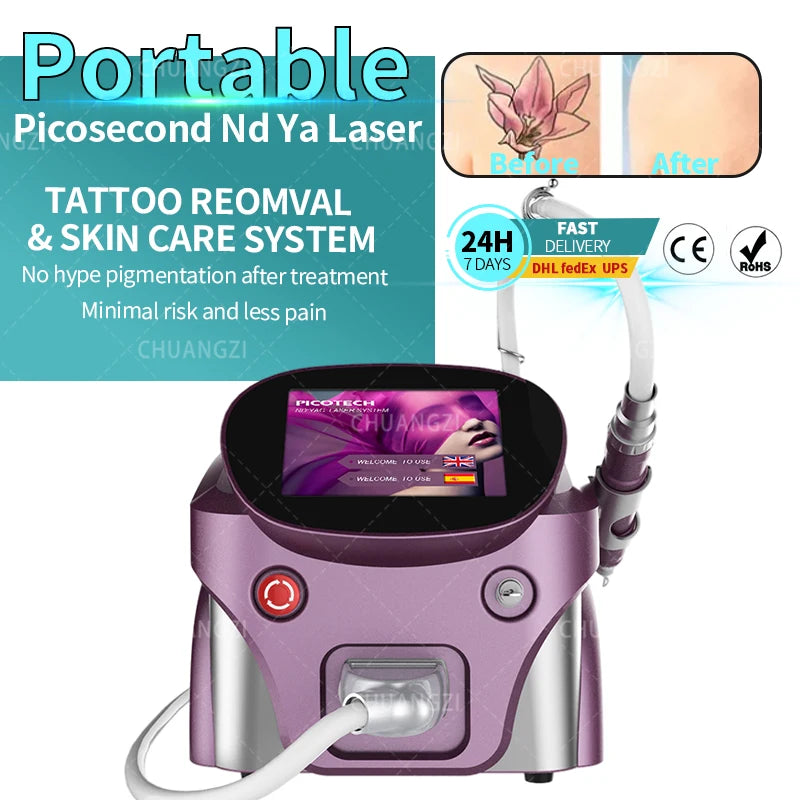 Portable Picosecond Tattoo Removal Laser