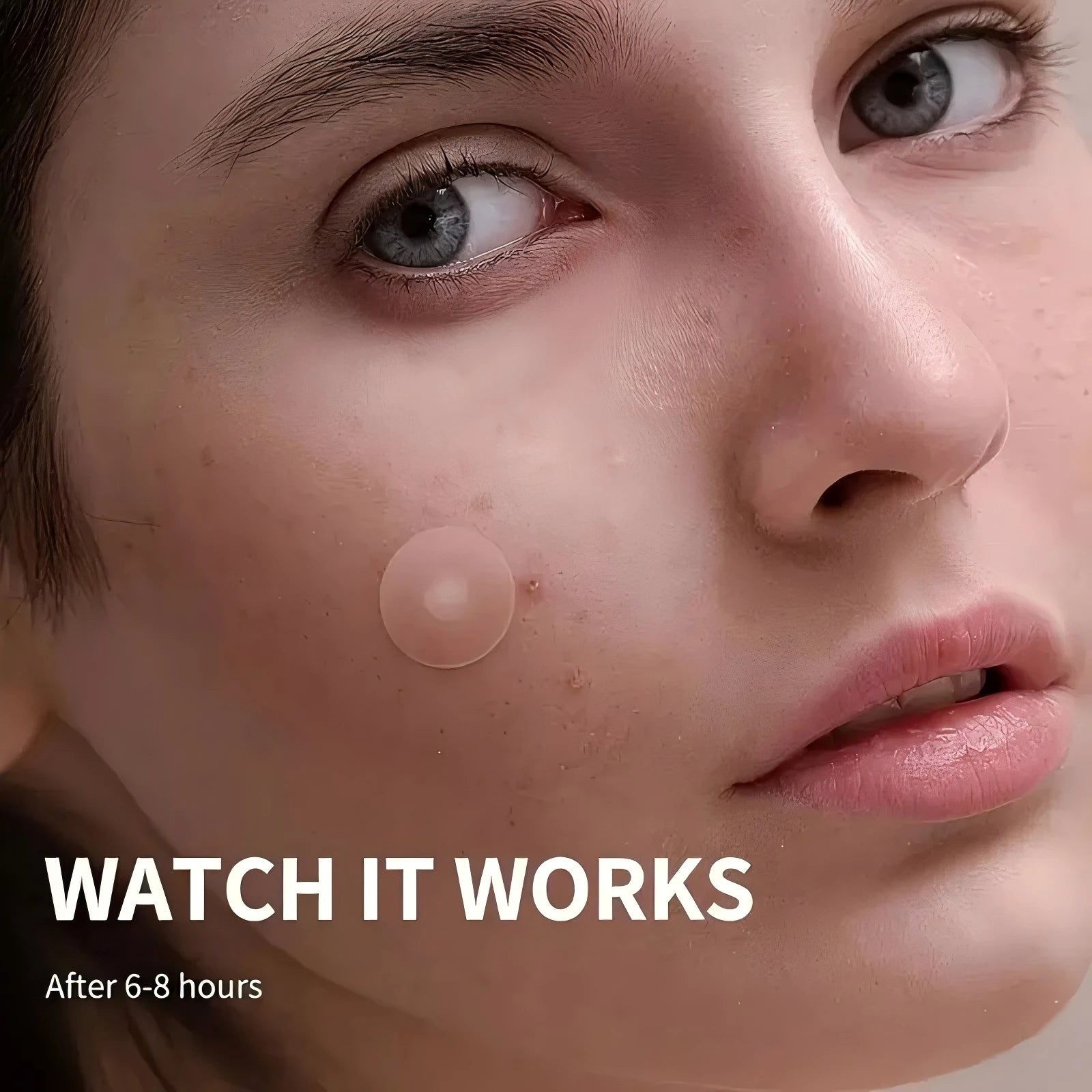 48PCS Invisible Acne Pimple Patch Stickers