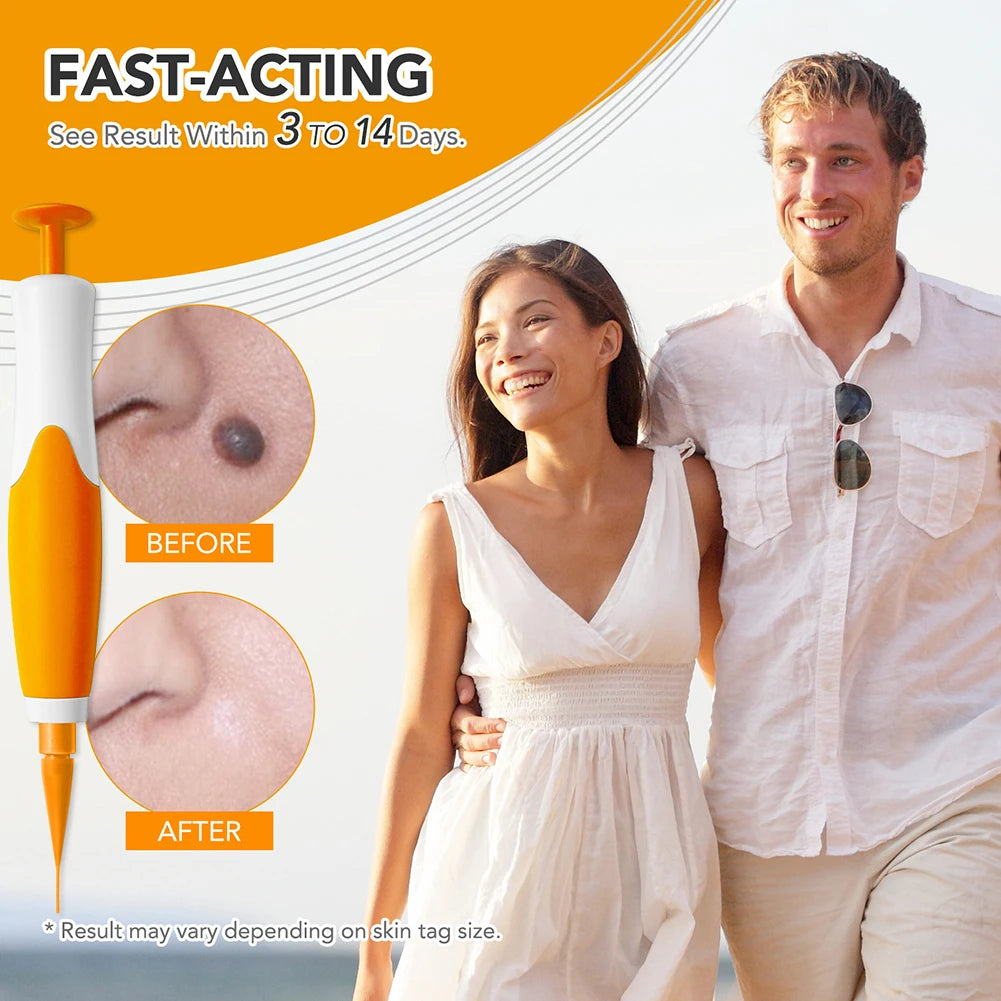 Rubber Rings Skin Tag Removal Tool