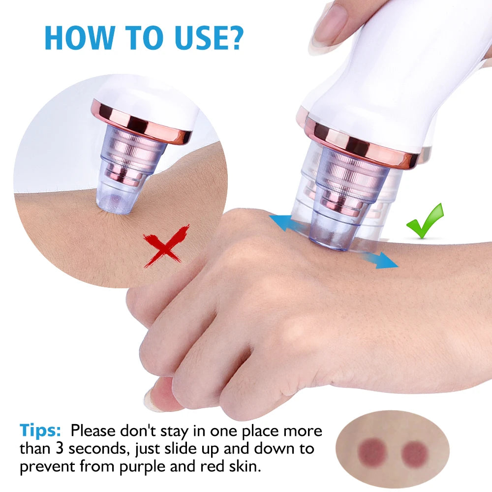 Vacuum Blackhead Remover USB Tool