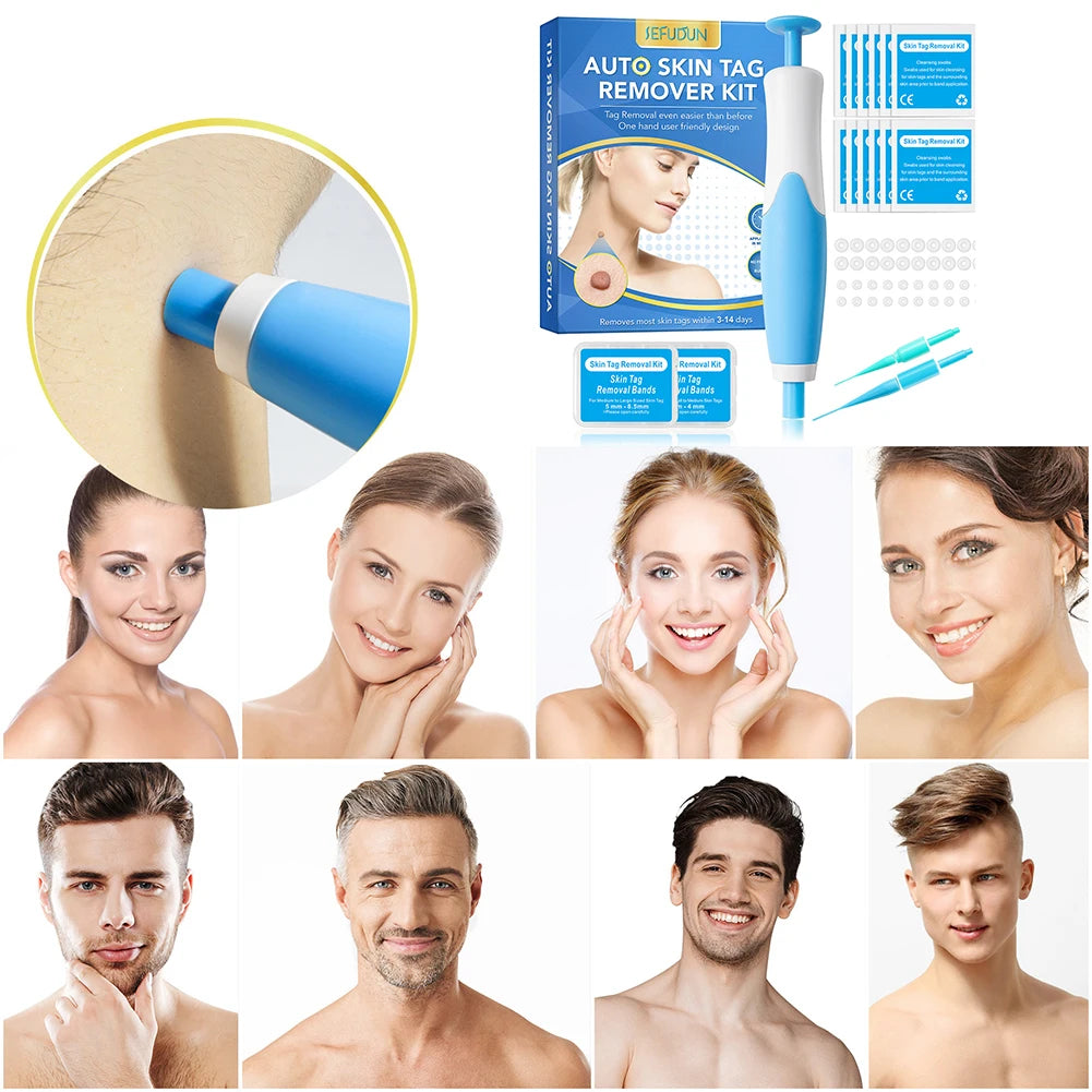 2-in-1 Auto Skin Tag & Mole Remover