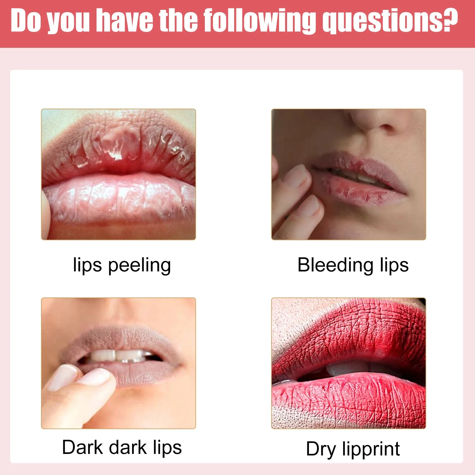 Lip Lightening & Moisturizing Cream