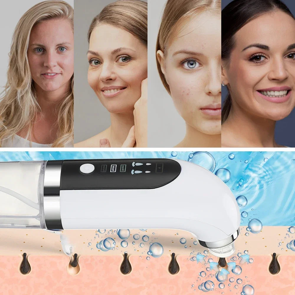 Electric Water Cycle Pore Vacuum