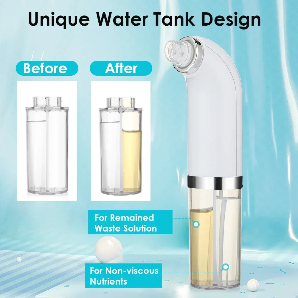 Electric Water Cycle Pore Vacuum