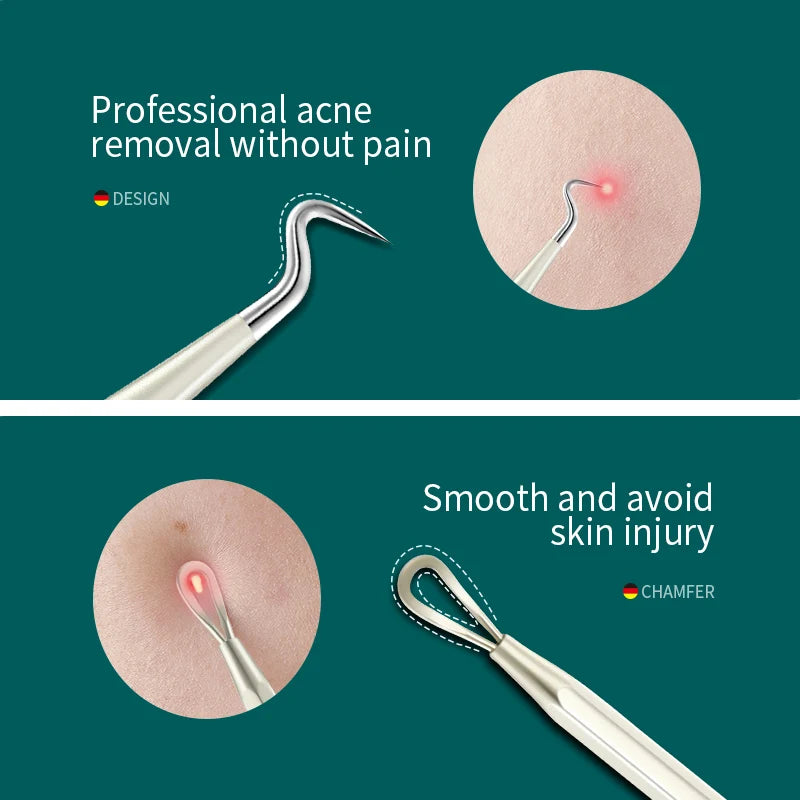 MR.GREEN Blackhead & Acne Extractor Set