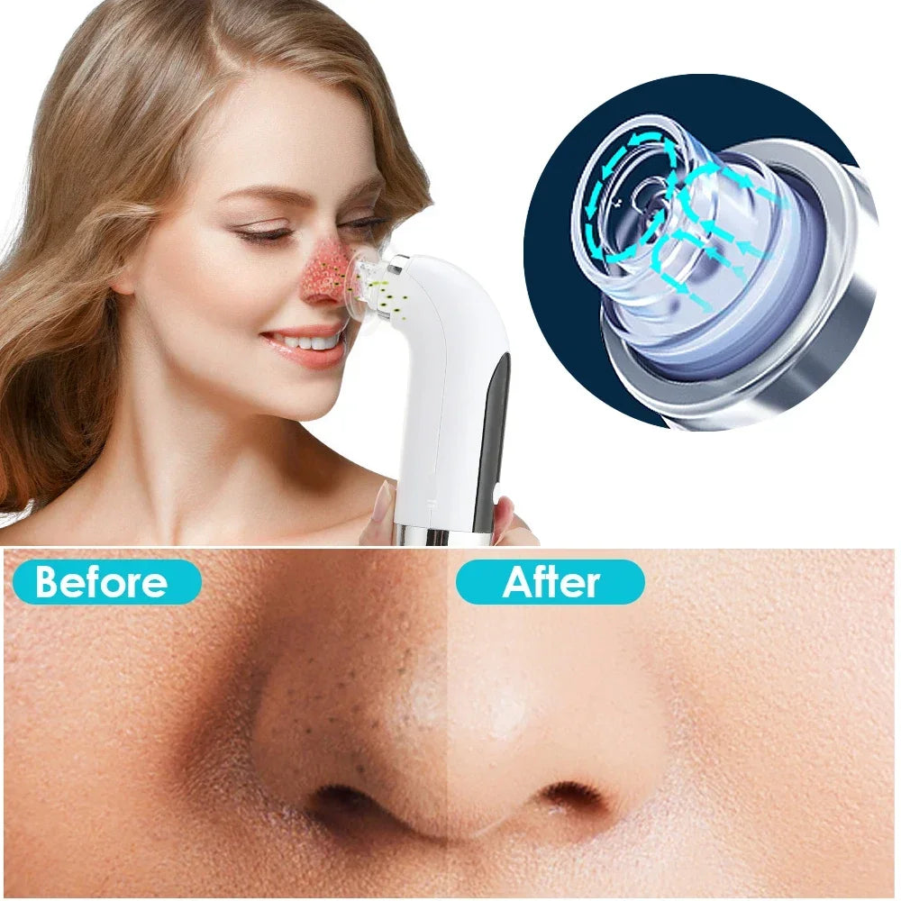 Electric Water Cycle Pore Vacuum